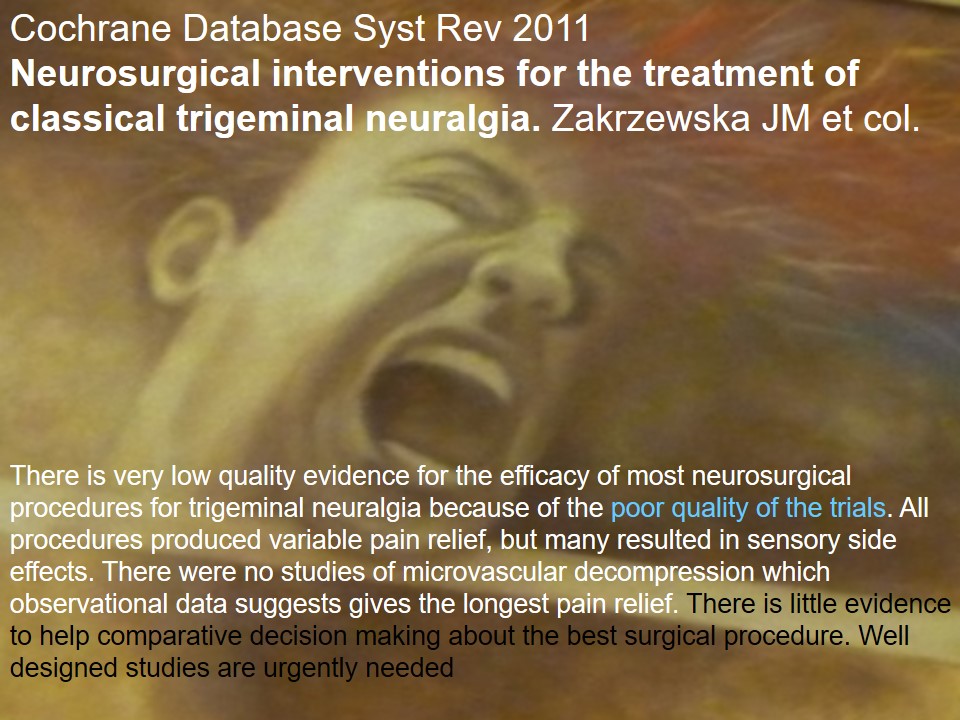 Neuralgia Esencial del Trigémino - Dr Guillermo Larrarte