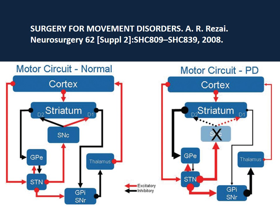 Metodología Estereotáctica o Estereotaxia - Dr Guillermo Larrarte
