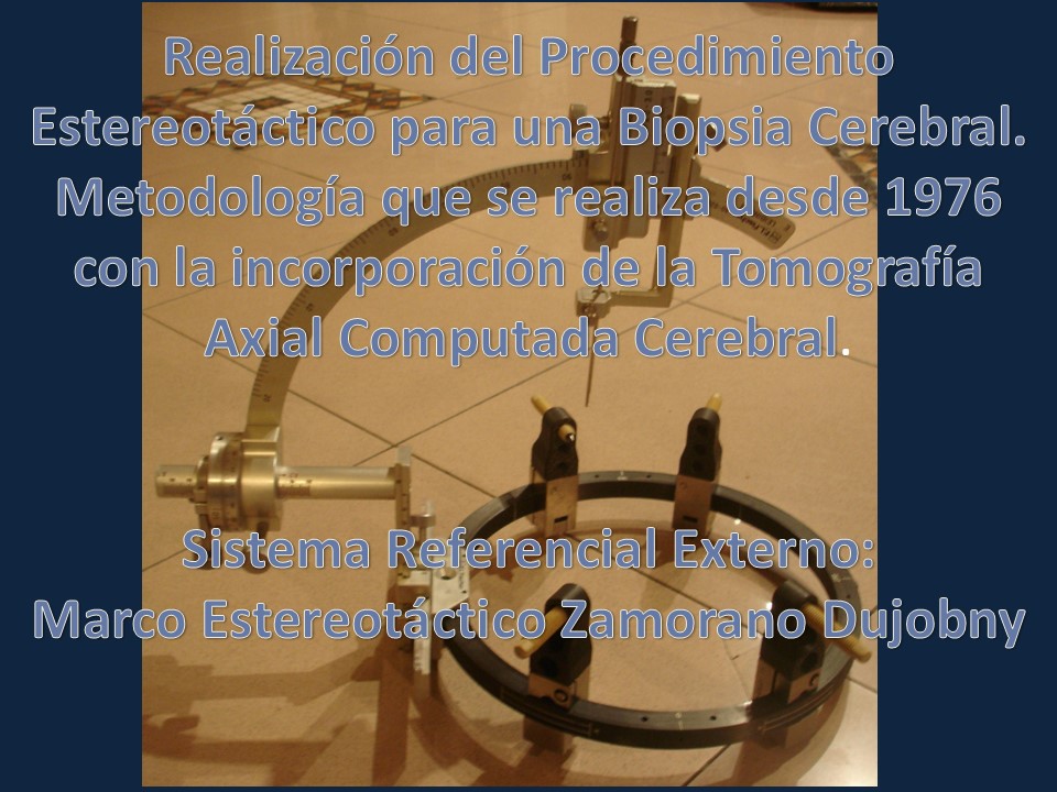 Metodología Estereotáctica o Estereotaxia - Dr Guillermo Larrarte