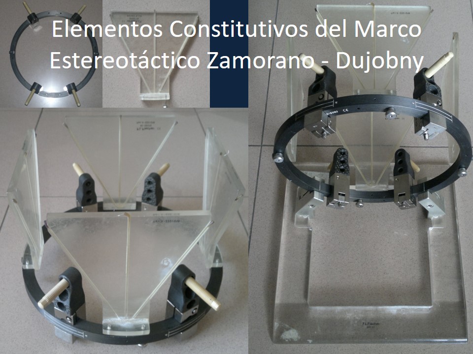 Metodología Estereotáctica o Estereotaxia - Dr Guillermo Larrarte