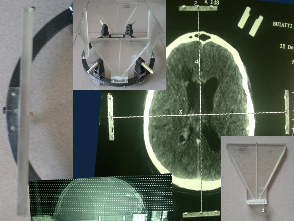 Metodología Estereotáctica o Estereotaxia - Dr Guillermo Larrarte