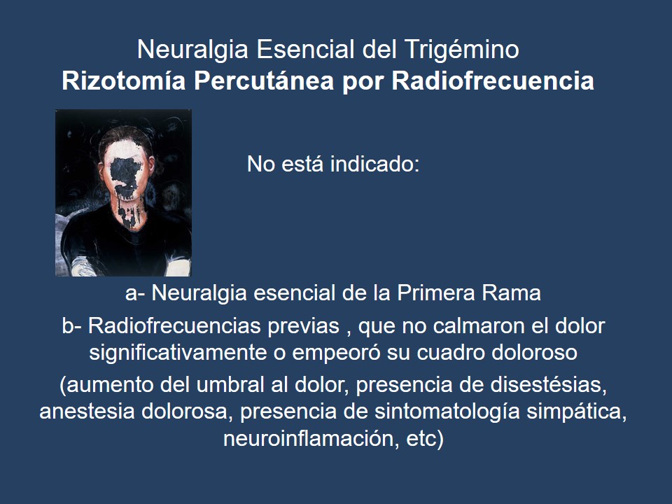 Neuralgia Esencial del Trigémino - Dr Guillermo Larrarte