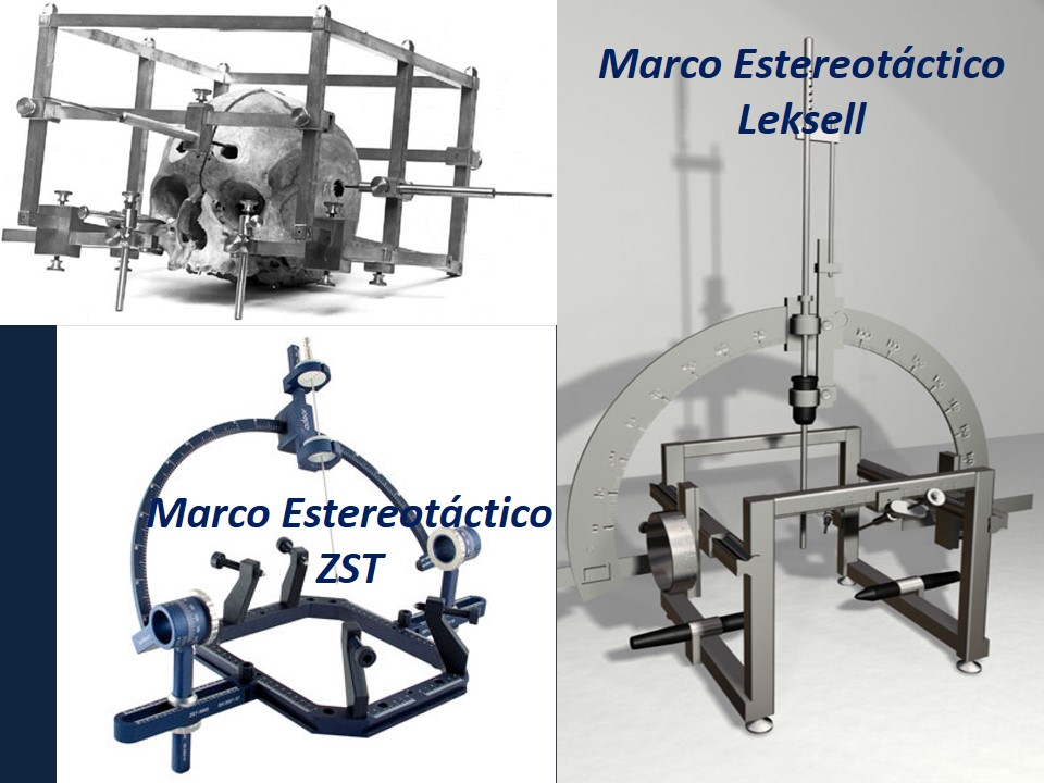 Metodología Estereotáctica o Estereotaxia - Dr Guillermo Larrarte
