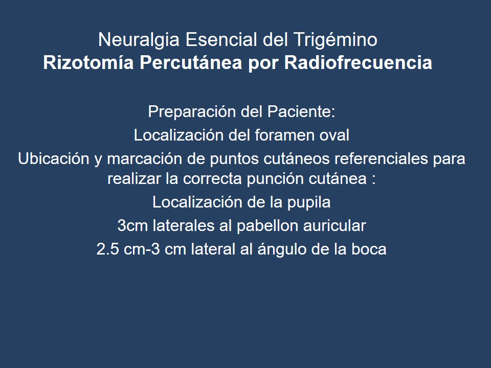 Neuralgia Esencial del Trigémino - Dr Guillermo Larrarte